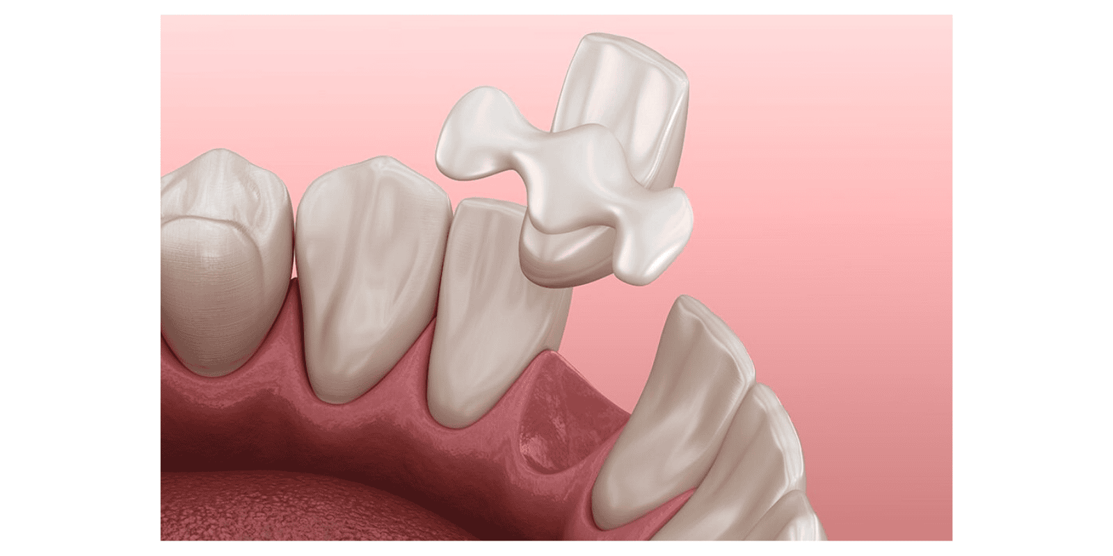 od4 - sementering (5).png